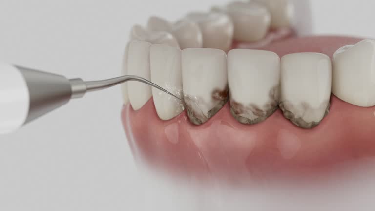 Trusted Wisdom Tooth Removal service in Falls City, NE - Dentist Open Now